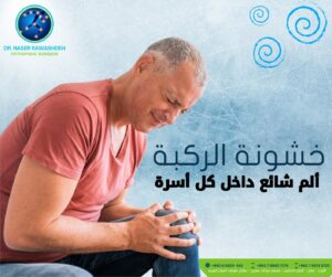 اشطر استشاري عظام ومفاصل في عمان