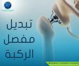 افضل طبيب زراعة مفصل الركبة في الاردن