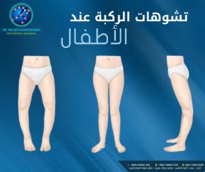 افضل طبيب للتشوهات الولادية في الاردن